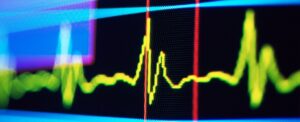 Ритм у пульсі людини може сигналізувати про майбутнє когнітивне погіршення