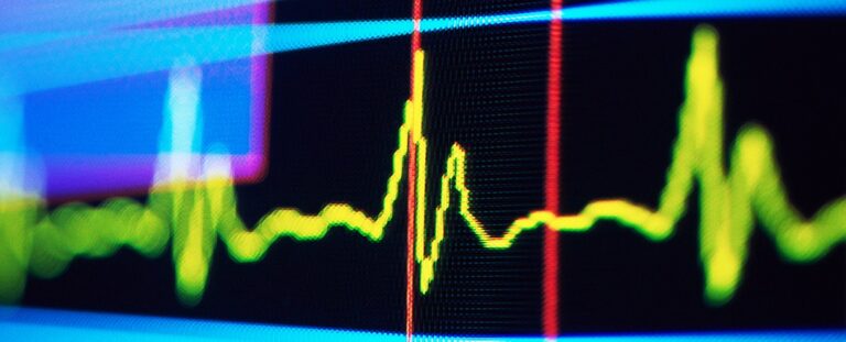Ритм у пульсі людини може сигналізувати про майбутнє когнітивне погіршення