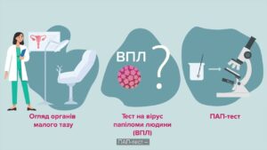 Турбота про жіноче здоров’я починається з профілактики