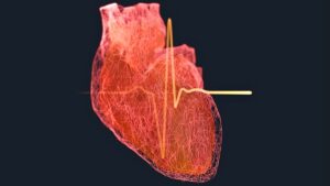 Вчені назвали вік, при якому ризик інфаркту у чоловіків різко зростає