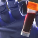 Вчені виявили зв&rsquo;язок між групою крові та ризиком діабету 2 типу