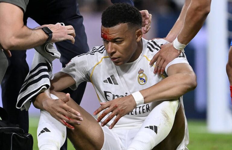 Розсічення не завада: Мбаппе очікують у матчі Ліги чемпіонів