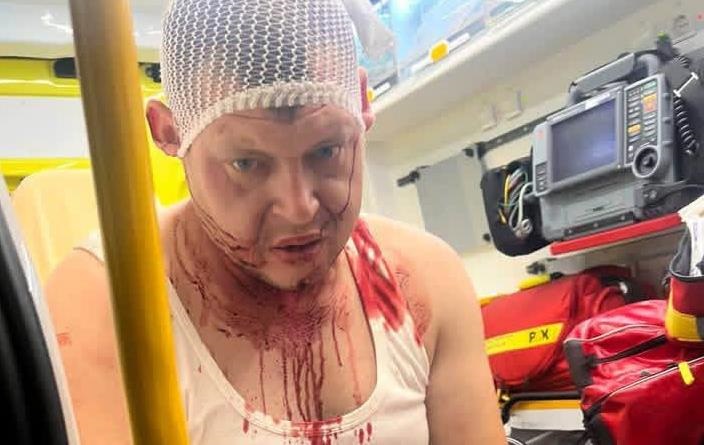 У Польщі стався черговий напад на українців